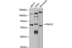 Western blot analysis of extracts of various cell lines, using PPM1D antibody (ABIN6132824, ABIN6146041, ABIN6146042 and ABIN6221792) at 1:1000 dilution. (PPM1D antibody  (AA 1-250))