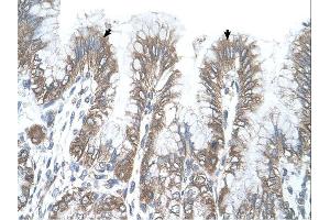 Immunohistochemistry (IHC) image for anti-arginine/serine-Rich Coiled-Coil 2 (RSRC2) (C-Term) antibody (ABIN2784458) (RSRC2 antibody  (C-Term))