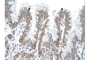 Immunohistochemistry (IHC) image for anti-arginine/serine-Rich Coiled-Coil 2 (RSRC2) (C-Term) antibody (ABIN311406) (RSRC2 antibody  (C-Term))