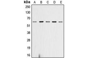 Western blot analysis of AKT (pS473) expression in HeLa (A), SP2/0 (B), mouse heart (C), rat heart (D), rat liver (E) whole cell lysates.