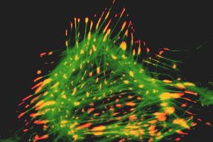 Immunocytochemical staining of a rat cardiac fibroblast using anti-Lipoma Preferred Partner, pAb (IG-817)  (LPP; red fluorescence) and a green-fluorescent phalloidin derivative staining filamentous actin. (LPP antibody  (AA 1-109))
