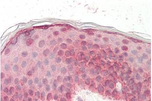 ABIN5539508 (5µg/ml) staining of paraffin embedded Human Skin. (EGF antibody  (Internal Region))
