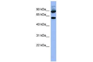RPS6KB1 antibody used at 1 ug/ml to detect target protein.