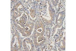 IHC analysis of COPE using anti-COPE antibody (ABIN7602509). (COPE antibody  (AA 80-308))