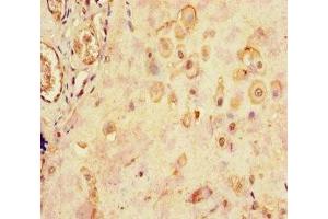 Immunohistochemistry of paraffin-embedded human placenta tissue using ABIN7158587 at dilution of 1:100 (LHB antibody  (AA 21-141))
