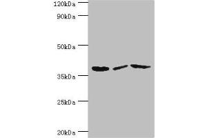 Western blot All lanes: P2RY14 antibody at 12 μg/mL Lane 1: Mouse heart tissue Lane 2: Mouse stomach tissue Lane 3: Mouse small intestine tissue Secondary Goat polyclonal to rabbit IgG at 1/10000 dilution Predicted band size: 39 kDa Observed band size: 39 kDa (P2RY14 antibody  (AA 209-338))