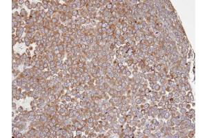 IHC-P Image Immunohistochemical analysis of paraffin-embedded PC13 xenograft, using PTGS1 , antibody at 1:100 dilution. (PTGS1 antibody  (C-Term))