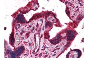 Human Placenta: Formalin-Fixed, Paraffin-Embedded (FFPE) (DPP8 antibody)