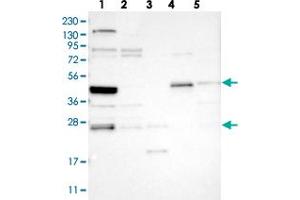 Western blot analysis of Lane 1: RT-4, Lane 2: U-251 MG, Lane 3: Human Plasma, Lane 4: Liver, Lane 5: Tonsil with SMAP2 polyclonal antibody .