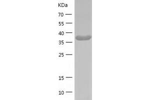 Western Blotting (WB) image for GDP-Mannose 4,6-Dehydratase (GMDS) (AA 1-372) protein (His tag) (ABIN7284539) (GMDS Protein (AA 1-372) (His tag))