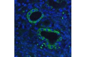 IF analysis of Hexokinase 1/HK1 using anti-Hexokinase 1/HK1 antibody (ABIN7600259). (Hexokinase 1 antibody  (AA 17-323))