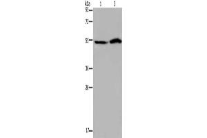 Gel: 8 % SDS-PAGE, Lysate: 40 μg, Lane 1-2: Hela cells, 293T cells, Primary antibody: ABIN7192423(SLC22A12 Antibody) at dilution 1/200, Secondary antibody: Goat anti rabbit IgG at 1/8000 dilution, Exposure time: 40 seconds (SLC22A12 antibody)