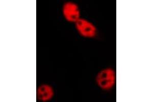 ABIN6269196 staining MCF7 by IF/ICC. (Cyclin E1 antibody  (C-Term))