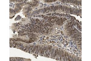 IHC analysis of FOXP1 using anti-FOXP1 antibody (ABIN7602780). (FOXP1 antibody  (C-Term))