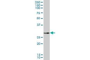 NAT2 MaxPab polyclonal antibody. (NAT2 antibody  (AA 1-290))