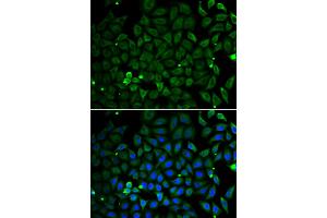 Immunofluorescence analysis of A549 cells using PARK2 antibody (ABIN4904678). (Parkin antibody)