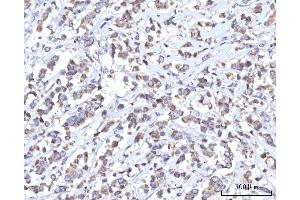 IHC analysis of C18orf22/RBFA using anti-C18orf22/RBFA antibody (ABIN7600106).