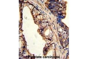 Immunohistochemistry (IHC) image for anti-Transglutaminase 4 (Prostate) (TGM4) antibody (ABIN3002879) (TGM4 antibody)