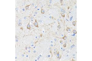 Immunohistochemistry of paraffin-embedded mouse brain using Neurofilament H Rabbit mAb (ABIN7268866) at dilution of 1:100 (40x lens).
