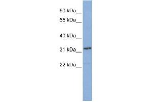 WB Suggested Anti-SNAPC2 Antibody Titration: 0. (SNAPC2 antibody  (N-Term))