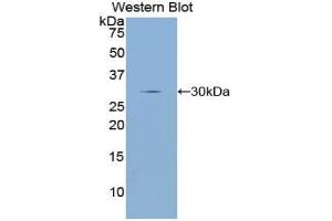 Detection of Recombinant DRD2, Rat using Polyclonal Antibody to Dopamine Receptor D2 (DRD2) (Dopamine d2 Receptor antibody  (AA 194-421))