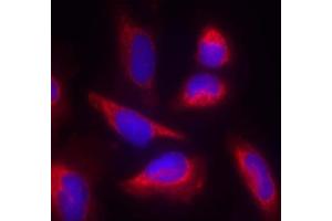 Immunofluorescence staining of methanol-fixed HeLa cells using eNOS (Ab-495) Antibody (E021235, Red) (ENOS antibody)