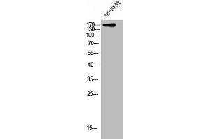 Western Blot analysis of SH-SY5Y cells using CLASP1 Polyclonal Antibody (CLASP1 antibody  (C-Term))