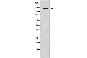 Western blot analysis of CROCC using COLO205 whole cell lysates (CROCC antibody  (N-Term))