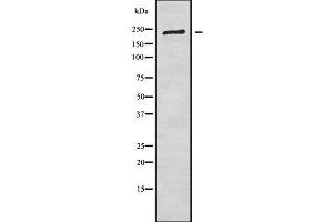 Western blot analysis of CROCC using COLO205 whole cell lysates (CROCC antibody  (N-Term))