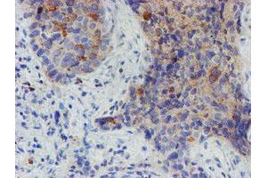 Image no. 1 for anti-Myoneurin (MYNN) (AA 10-300) antibody (ABIN1490790) (Myoneurin antibody  (AA 10-300))