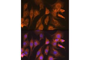 Immunofluorescence analysis of NIH-3T3 cells using Guanylyl Cyclase beta 1 (GUCY1B3) (GUCY1B3) Rabbit mAb (ABIN7267551) at dilution of 1:100 (40x lens). (GUCY1B3 antibody)