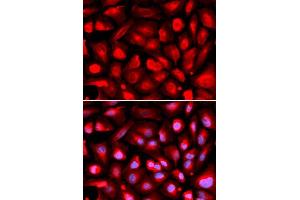 Immunofluorescence analysis of U2OS cell using ETS1 antibody.