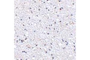 Immunohistochemistry of TSLP in human brain tissue with this product at 2. (Thymic Stromal Lymphopoietin antibody  (Center))