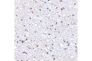 Immunohistochemistry of TSLP in human brain tissue with this product at 2. (Thymic Stromal Lymphopoietin antibody  (Center))