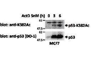 Western Blotting (WB) image for anti-Tumor Protein P53 (TP53) (acLys382) antibody (ABIN3201008) (p53 antibody  (acLys382))