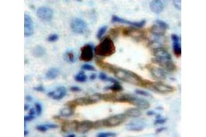 IHC-P analysis of Liver tissue, with DAB staining. (CEACAM1 antibody  (AA 35-143))