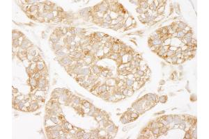Immunohistochemistry (IHC) image for anti-Lysyl-tRNA Synthetase (KARS) (C-Term) antibody (ABIN7448981)