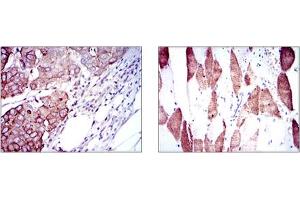 Immunohistochemistry (IHC) image for anti-Ribosomal Protein S6 Kinase, 70kDa, Polypeptide 1 (RPS6KB1) antibody (ABIN1108904) (RPS6KB1 antibody)