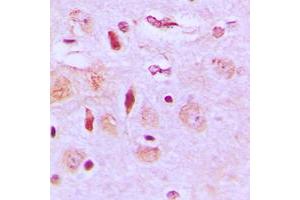 Immunohistochemical analysis of NEURL2 staining in human brain formalin fixed paraffin embedded tissue section. (NEURL2 antibody  (Center))