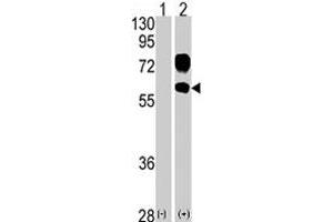 KREMEN1 antibody  (N-Term)
