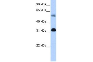 OXCT1 antibody used at 0. (OXCT1 antibody  (N-Term))