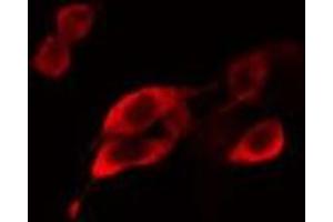 ABIN6275107 staining MCF7 cells by IF/ICC. (ELOVL5 antibody  (C-Term))