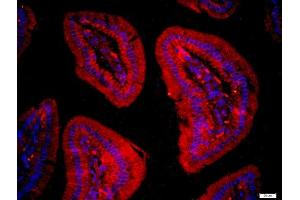 Immunofluorescence (Paraffin-embedded Sections) (IF (p)) image for anti-Family with Sequence Similarity 134, Member C (FAM134C) (AA 76-180) antibody (ABIN872917)