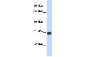 WB Suggested Anti-ZMYND19 Antibody Titration:  0.