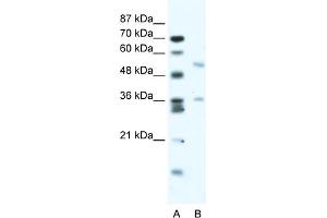 WB Suggested Anti-BTBD3 Antibody Titration:  2. (BTBD3 antibody  (Middle Region))