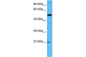 Host:  Mouse  Target Name:  MECP2  Sample Tissue:  Mouse Brain  Antibody Dilution:  1ug/ml