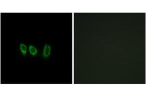 Immunofluorescence analysis of A549 cells, using CSTL1 Antibody. (CSTL1 antibody  (AA 61-110))
