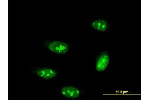 Immunofluorescence of monoclonal antibody to TP53RK on HeLa cell. (TP53RK antibody  (AA 154-253))