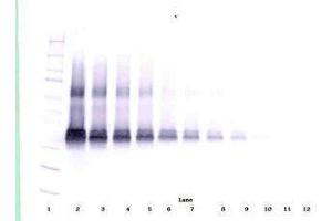 Image no. 1 for anti-Vascular Endothelial Growth Factor A (VEGFA) antibody (ABIN465335) (VEGFA antibody)