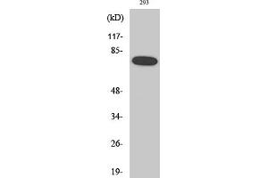 Western Blotting (WB) image for anti-Nuclear Factor-kB p65 (NFkBP65) (pSer468) antibody (ABIN5961221) (NF-kB p65 antibody  (pSer468))